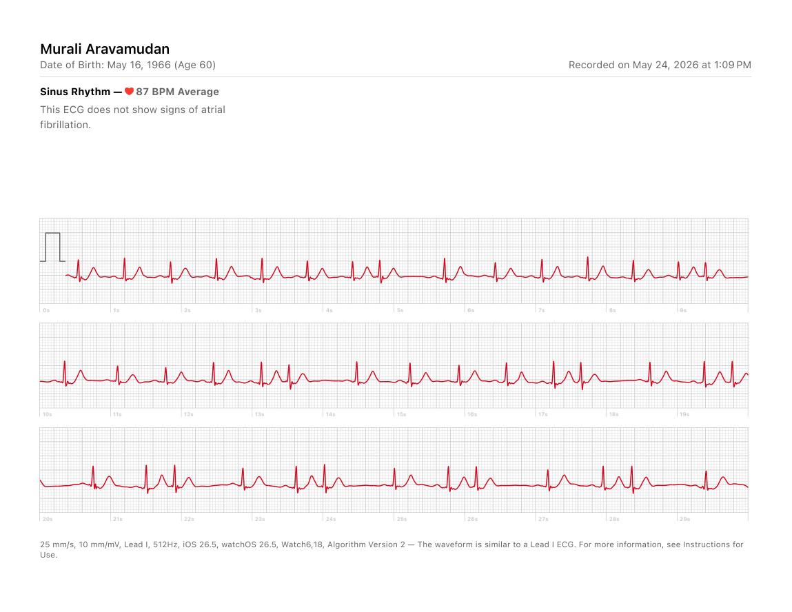 Input ECG overview