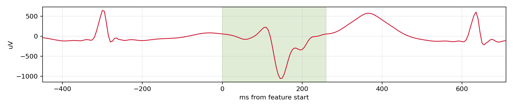Match waveform