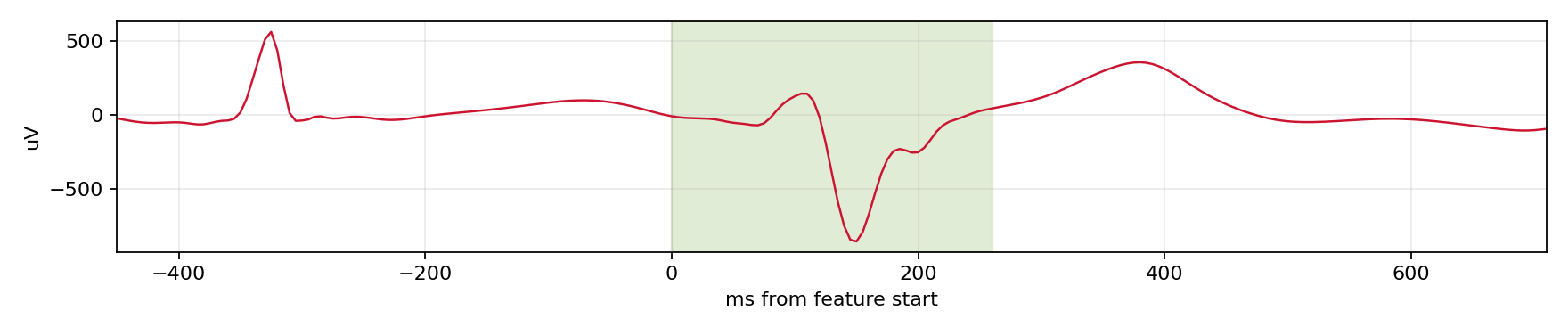 Match waveform