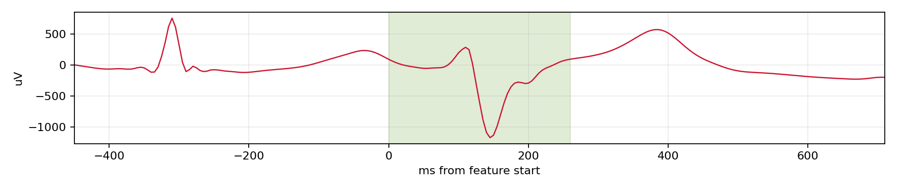 Match waveform