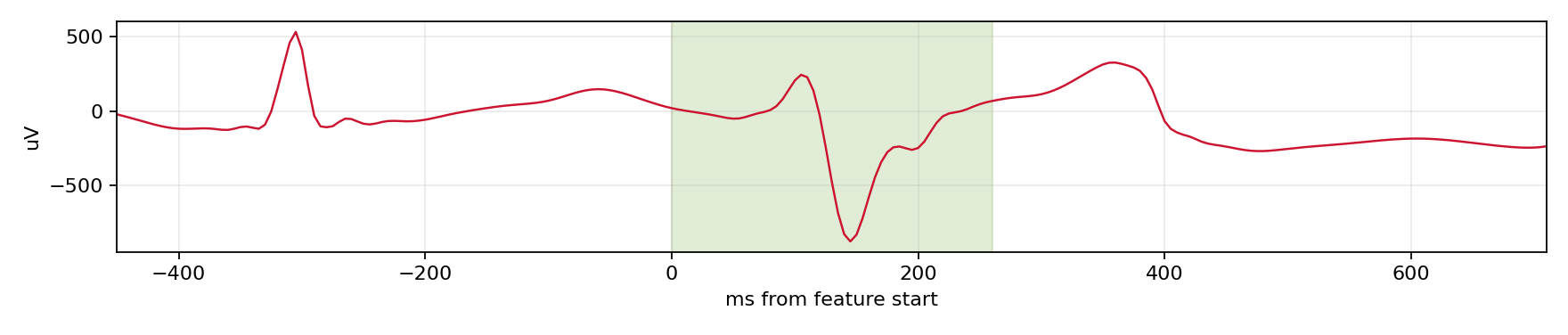 Match waveform
