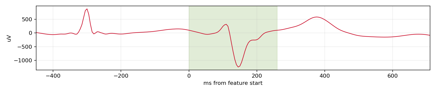 Match waveform