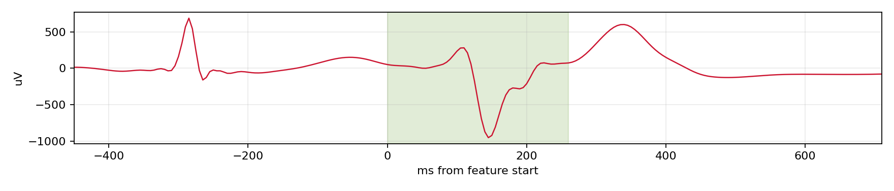 Match waveform