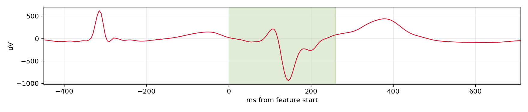 Match waveform