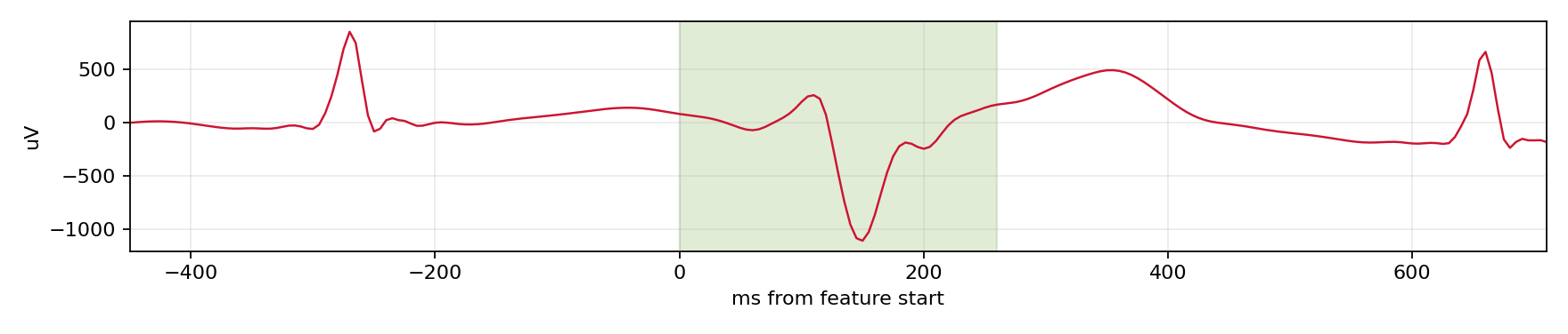 Match waveform