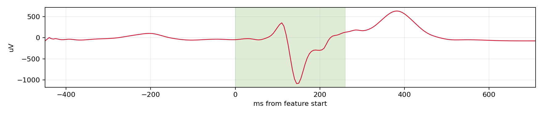 Match waveform