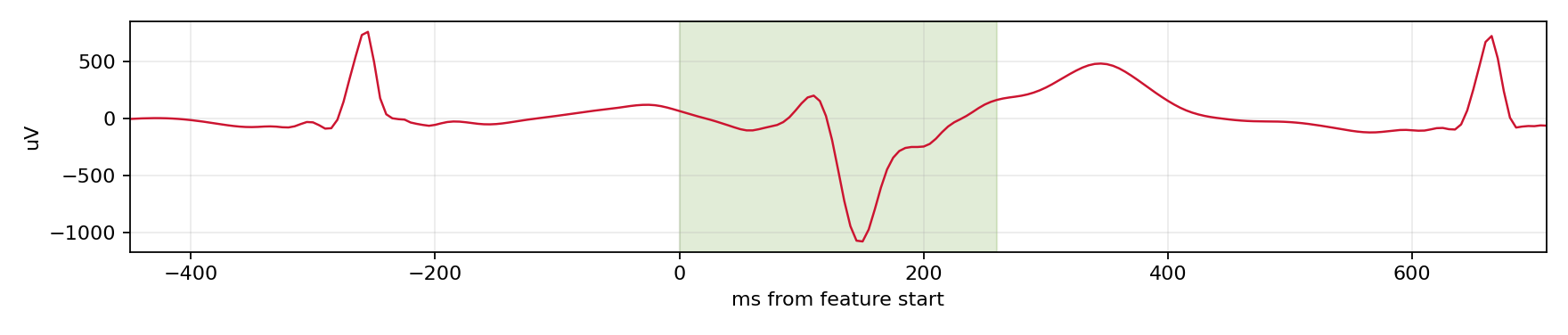 Match waveform