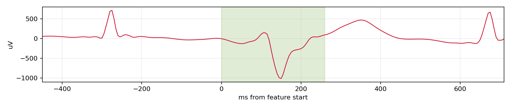 Match waveform