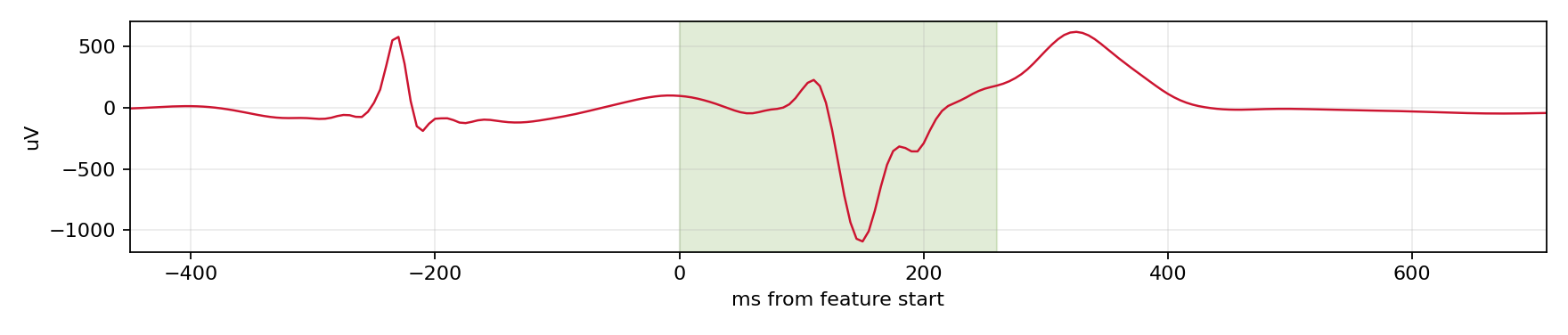 Match waveform