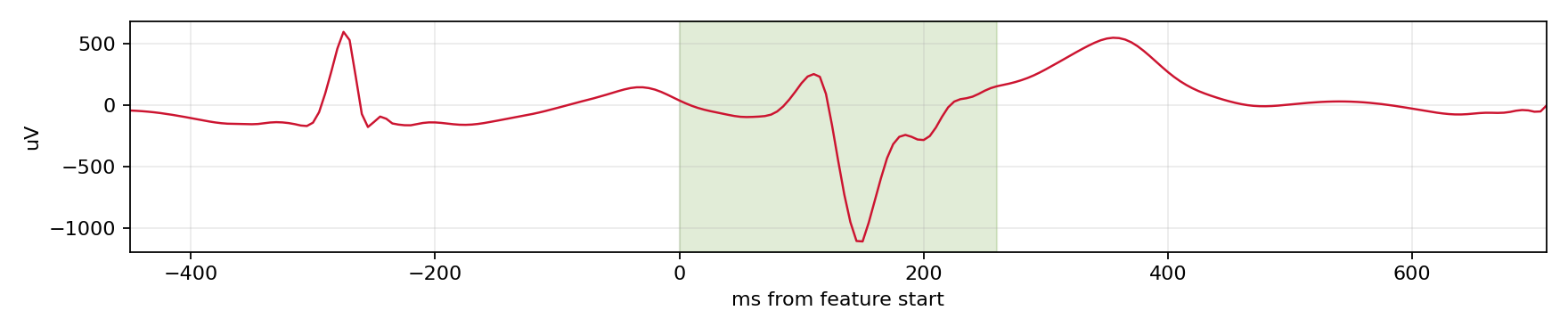 Match waveform