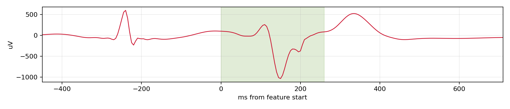 Match waveform