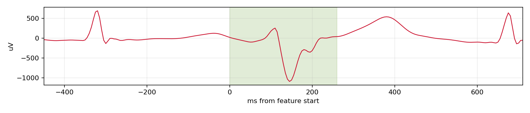 Match waveform