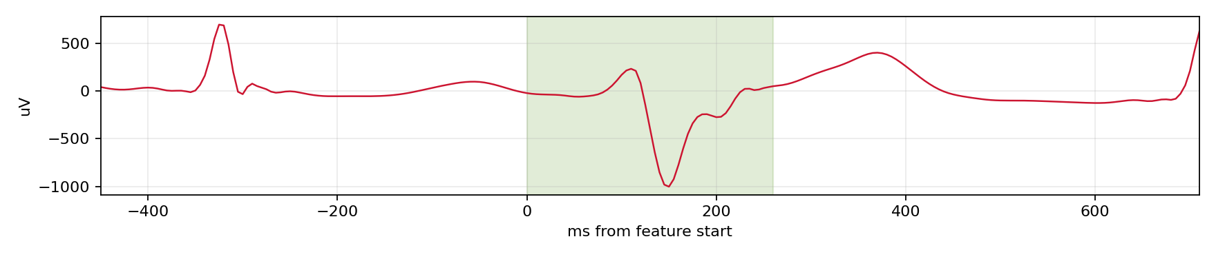 Match waveform