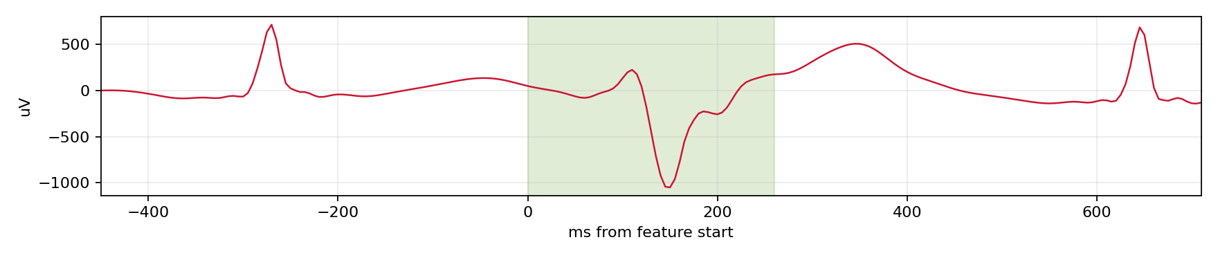 Match waveform