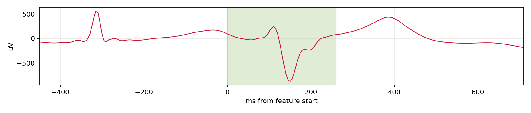 Match waveform