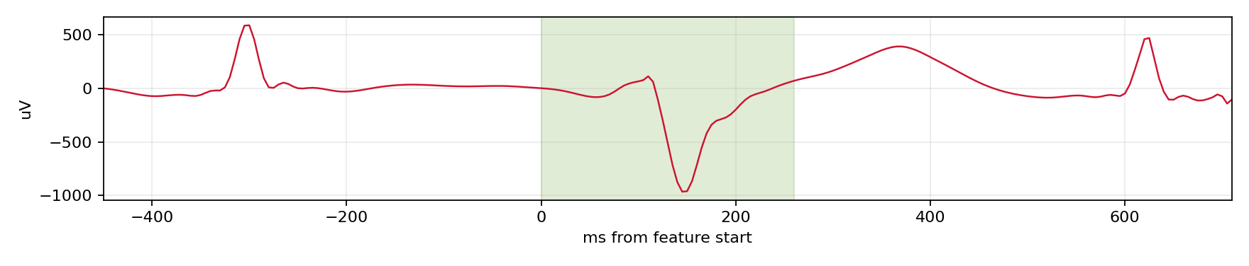 Match waveform