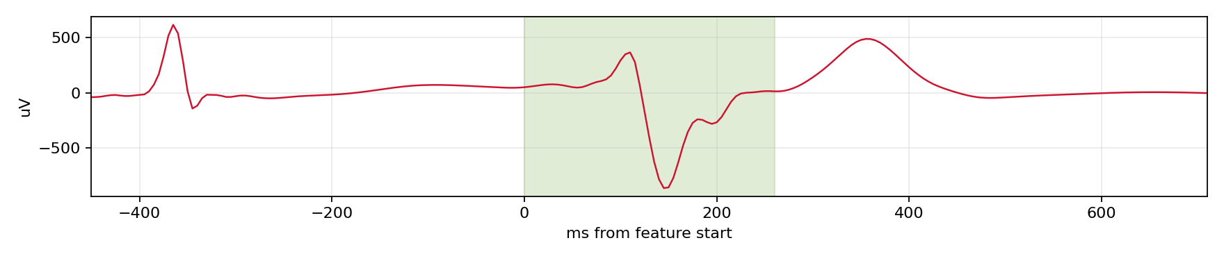Match waveform