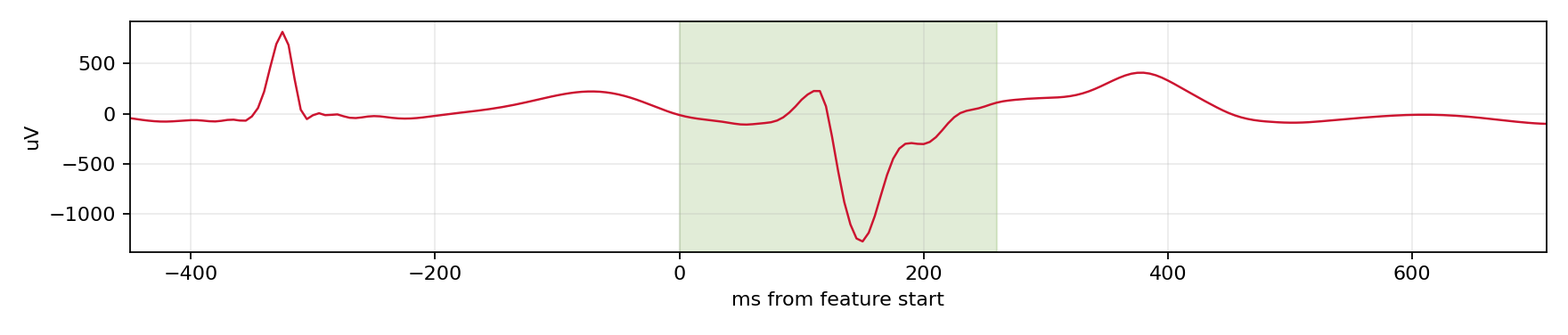 Match waveform