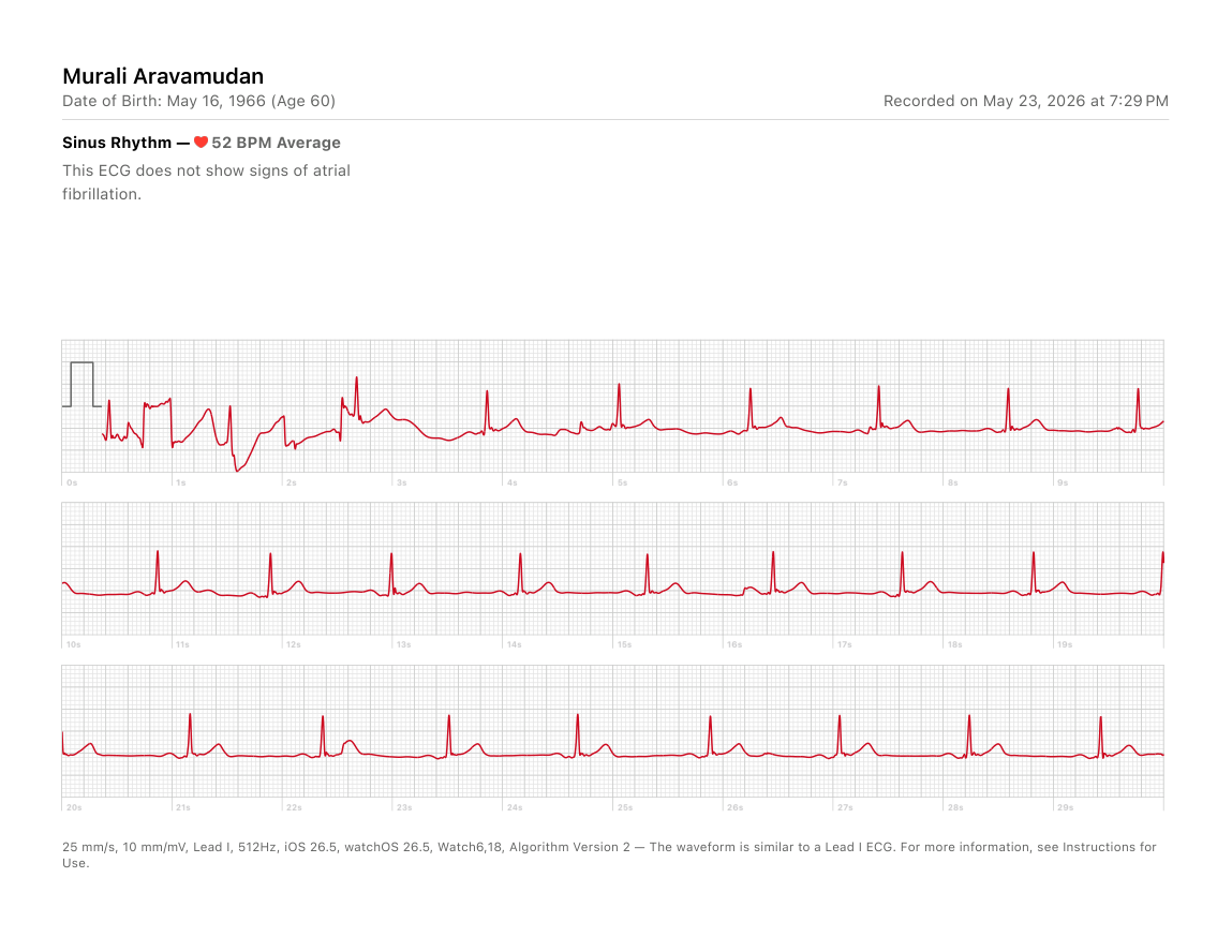 Input ECG overview