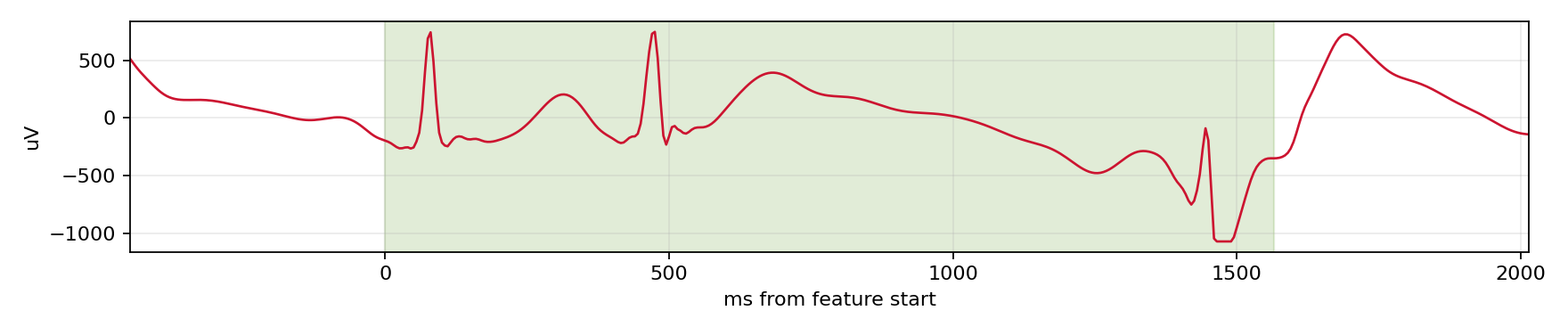 Match waveform