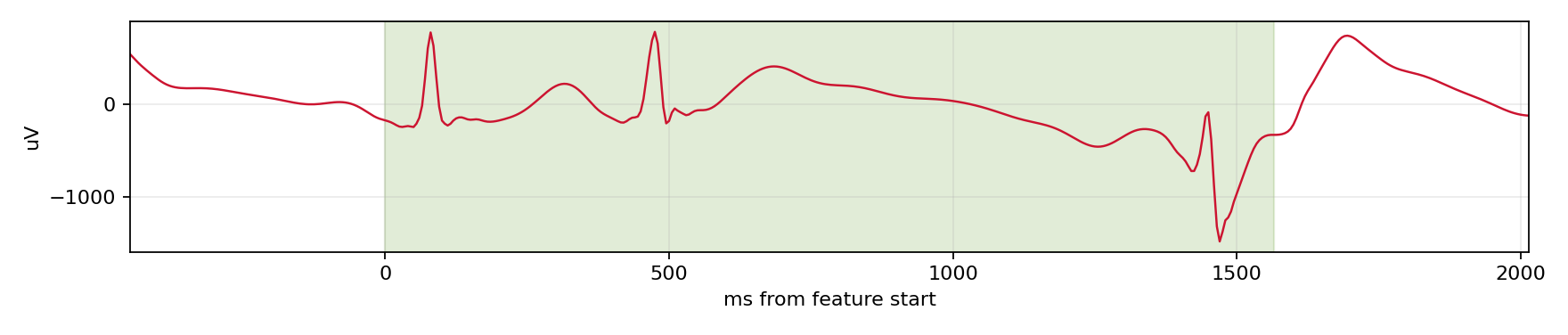 Match waveform