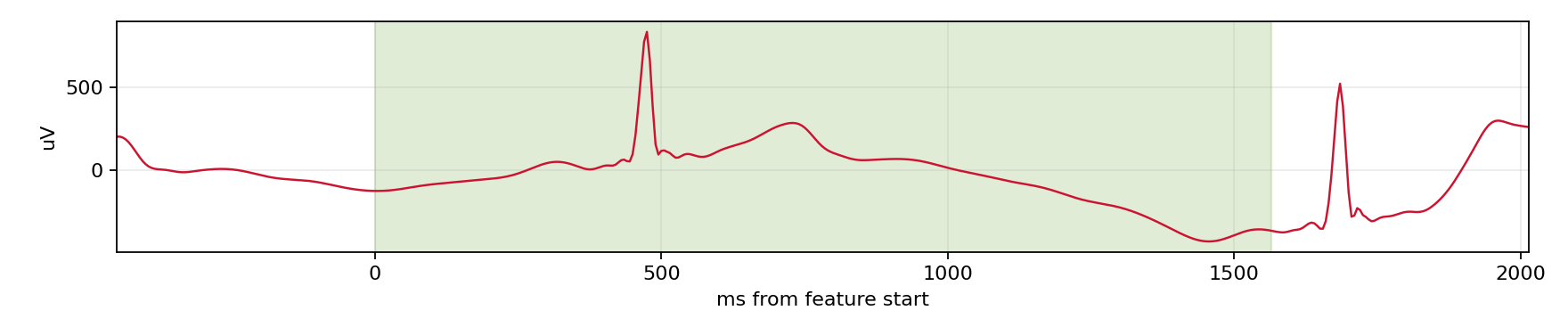 Match waveform