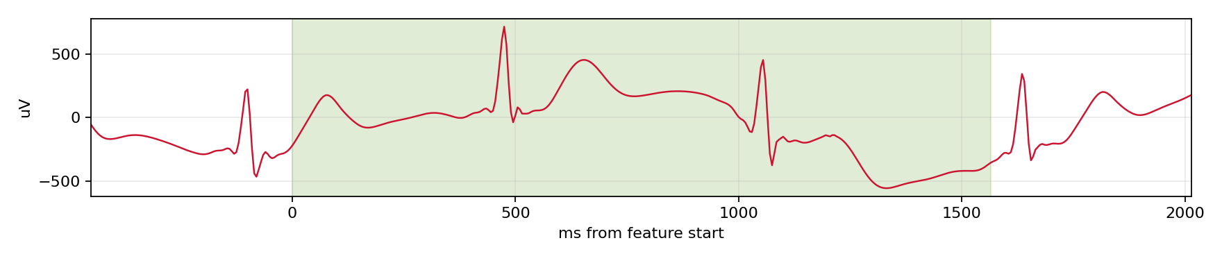 Match waveform