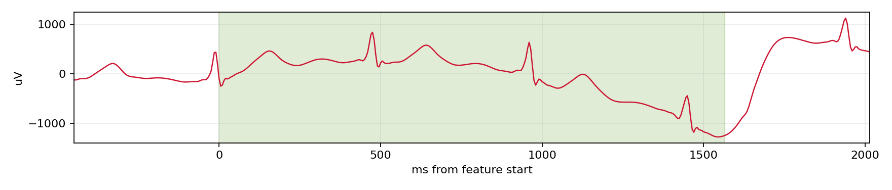 Match waveform
