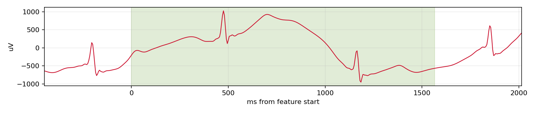 Match waveform