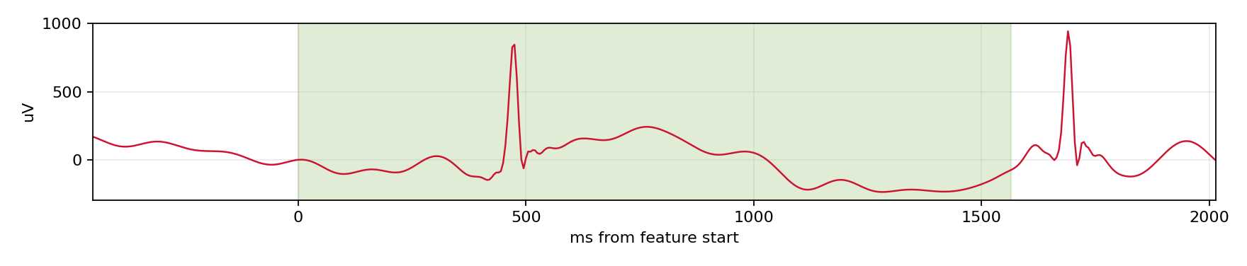 Match waveform