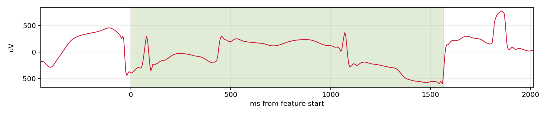 Match waveform