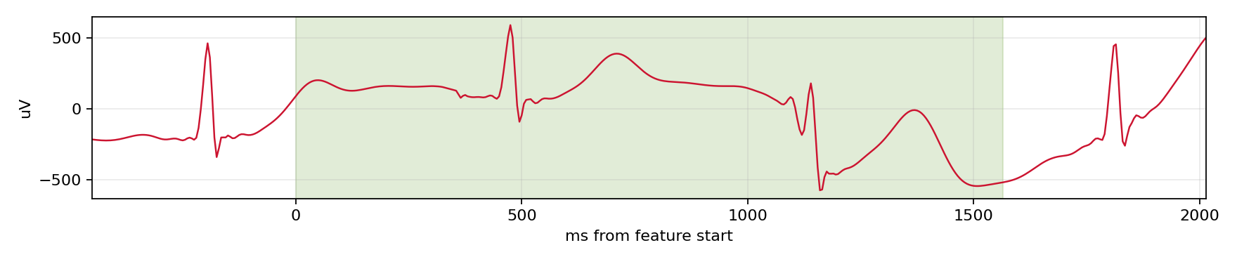 Match waveform