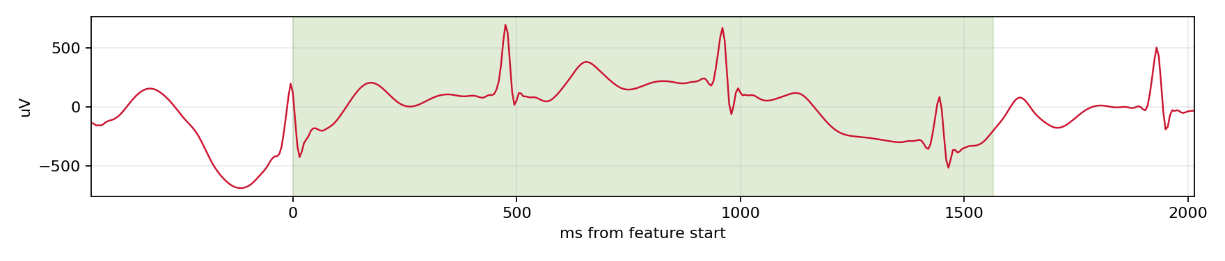 Match waveform