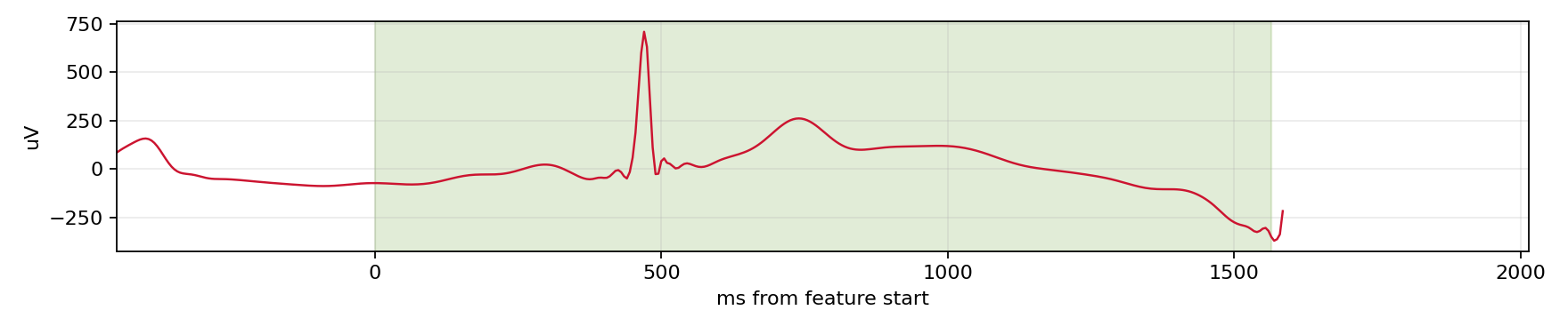Match waveform