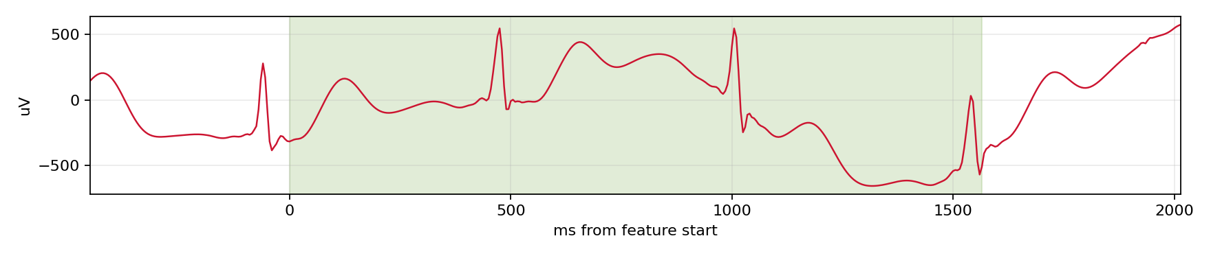 Match waveform