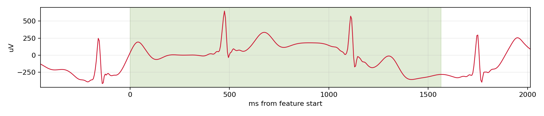 Match waveform