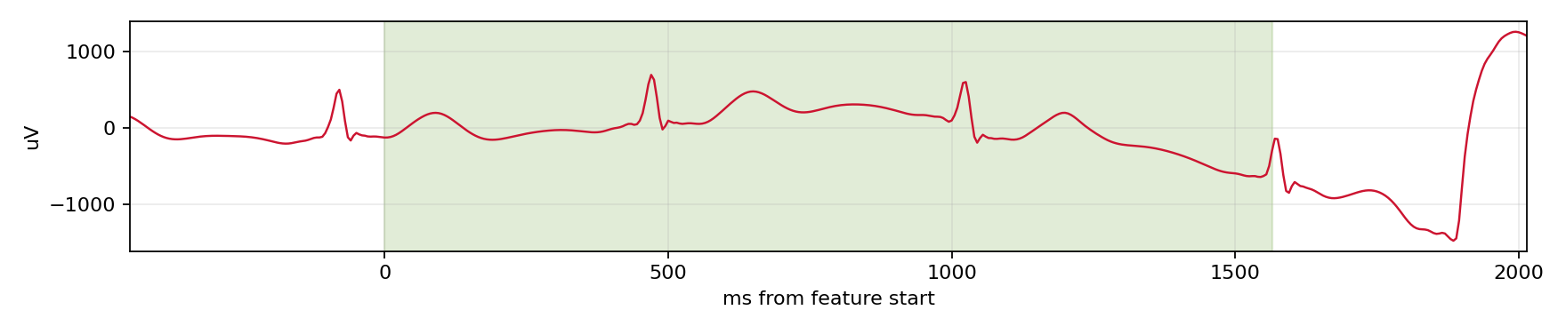 Match waveform