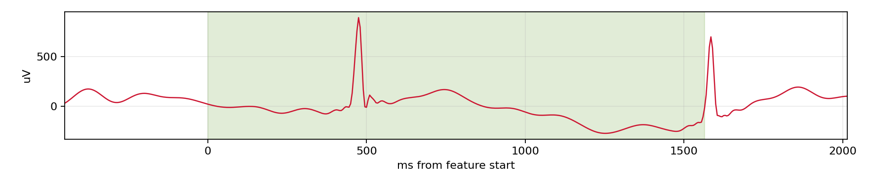 Match waveform