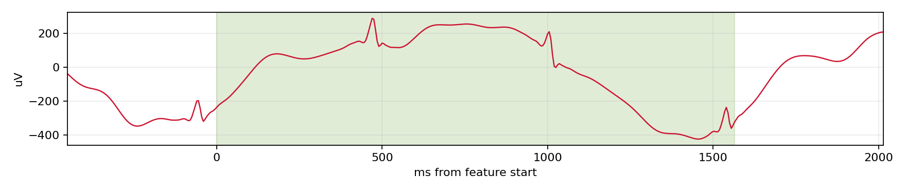 Match waveform