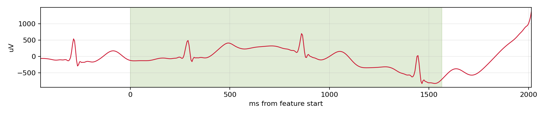 Match waveform