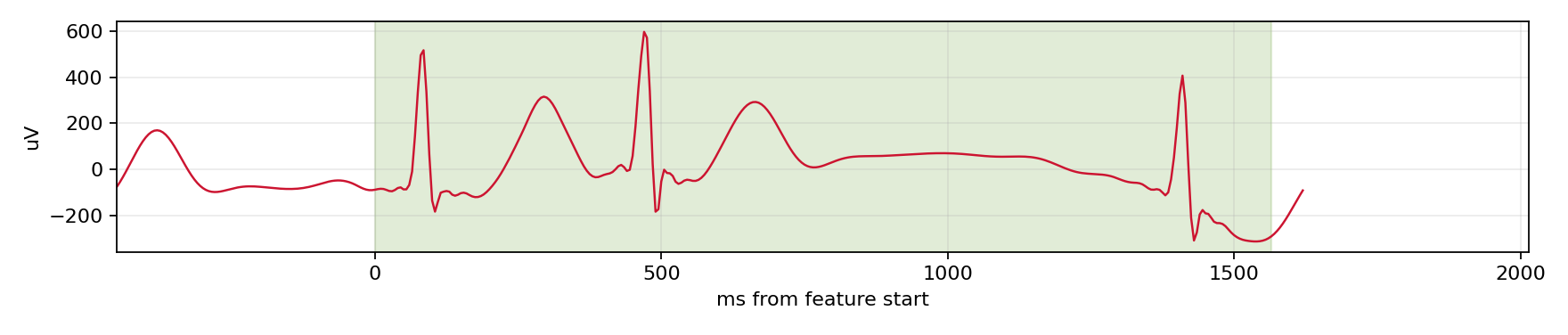 Match waveform