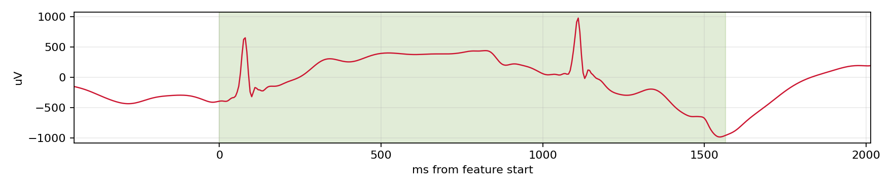Match waveform