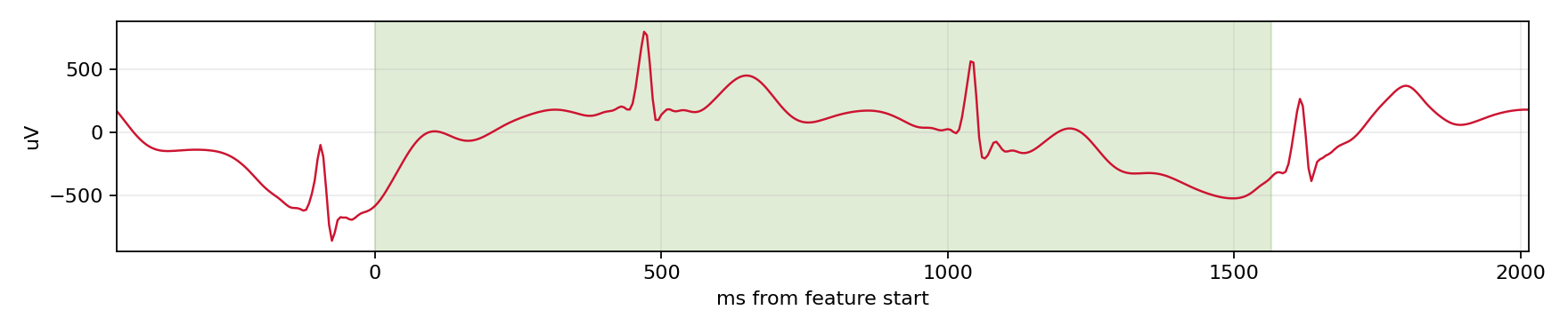 Match waveform