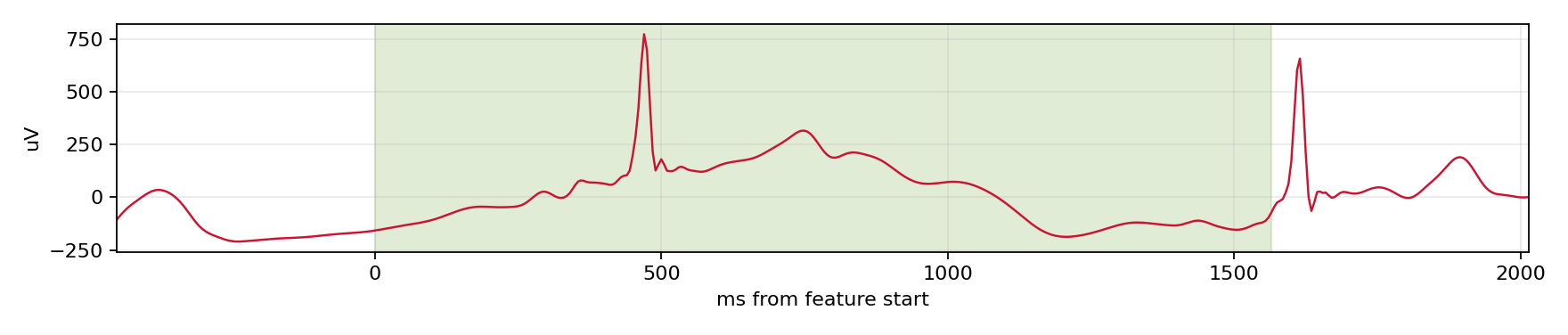 Match waveform